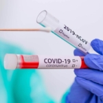 PreOp Covid and Blood Test